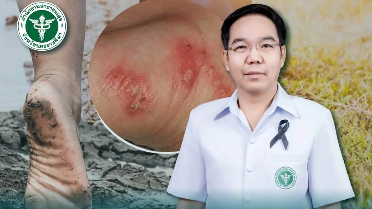 โคราชไข้ดินป่วยสะสม 140 ราย เสียชีวิต 15 ราย สาธารณสุขเตือนปลายฝนเสี่ยงพุ่ง